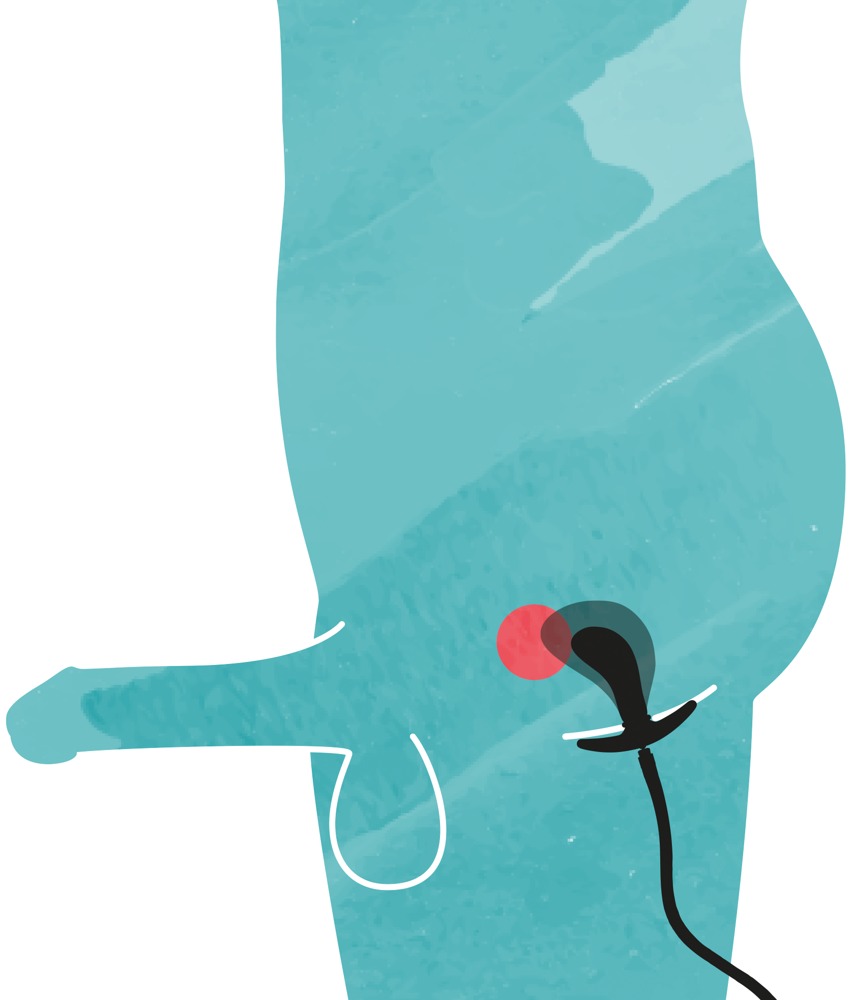 Inflatable Plug - Afbeelding 12